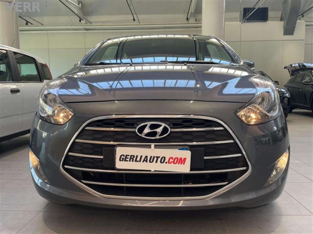 iX20 iX20 ix20 1.6 Xpossible a